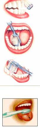 Tecnica de cepillado