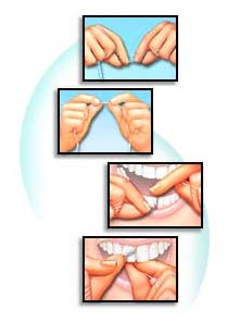 Pasaje del hilo dental