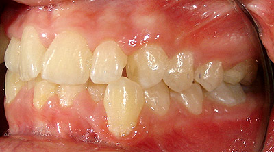 Foto lateral