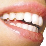 estetica_dental_01