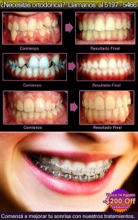 promo_ortdoncia_b_2012