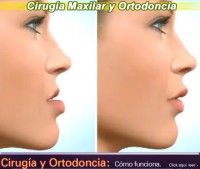 tapa_cirugia_ortodoncia