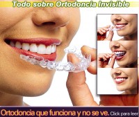 tapa_home_ortodoncia_invisible
