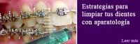 Estrategias para limpiar tu aparatología ortodontica