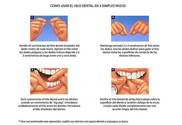Pasaje del hilo dental