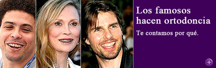 Los famosos hacen ortodoncia con especialistas. Nosotros te contamos por qué.