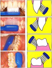 Técnicas de cepillado dental