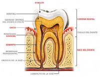tratamiento de conducto