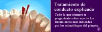 Endodoncia, tratamientos de conducto