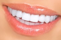 bocas saludables con ortodoncia salud