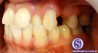 Ortodoncia e Implantes