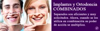 Ortodoncia implantes