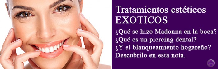 La estética dental hace referencia a una serie de tratamientos dentales diseñados para mejorar la sonrisa. Desde carillas, ortodoncia, implantes, blanqueamientos,hasta piercing dentales y restauraciones estéticas. Los pacientes pueden elegir entre una variedad de soluciones para restaurar la salud y embellecer su sonrisa.