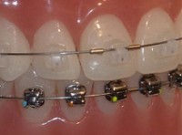 Damon Clear Damon Q – copia