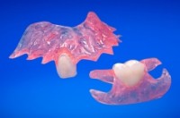 Prótesis removible completas y parciales