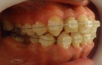 12-Vista lateral derecho