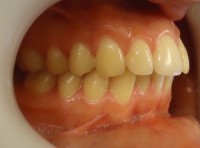 19  -Vista lateral derecho