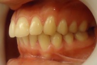 20 – Vista lateral izq