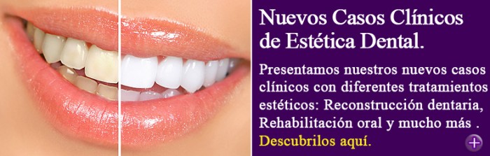 Casos clínicos estético dentales