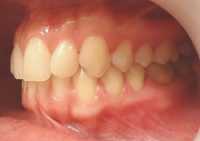 2- Vista lateral izquierdo