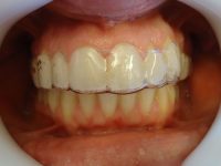 11-secuencia de tratamiento