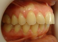 3- Vista lateral derecho