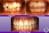 41–Antes-y-depues-final